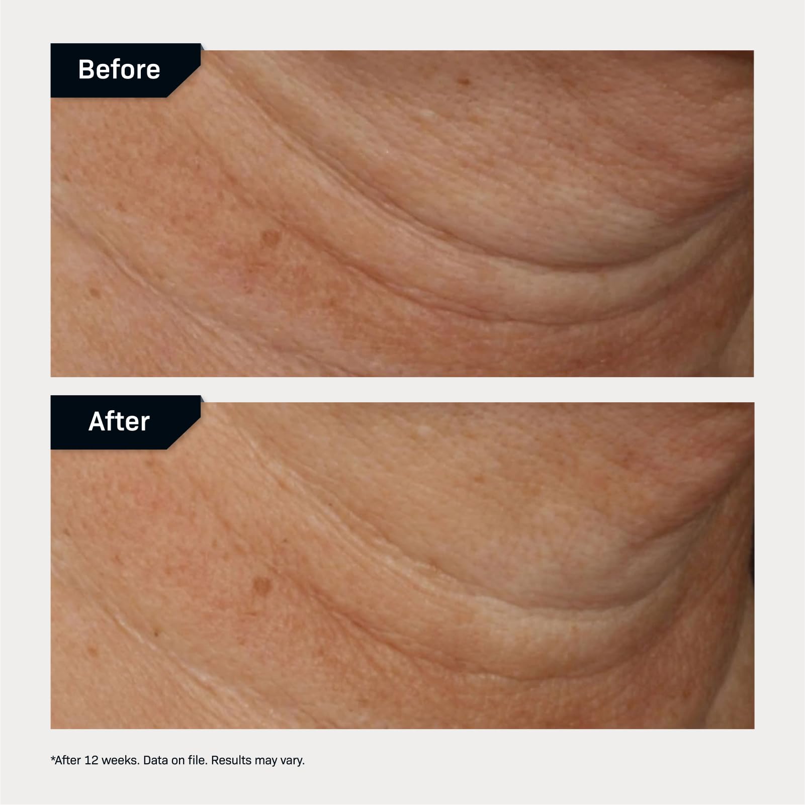 Revision Skincare Nectifirm® Advanced, Anti Aging Neck Firming Cream with Peptides for Fine Lines, Wrinkles and Crepey Skin, 1.7 oz